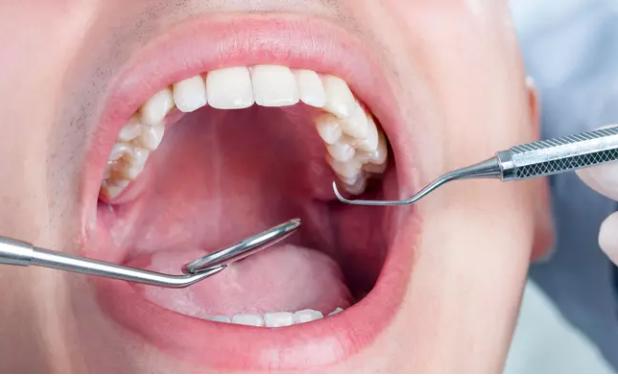 Sakit Sejak Kecil, Dokter Temukan 526 Gigi dalam Rahang Anak Ini